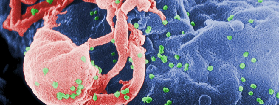 Новая капсула позволит принимать лекарства от ВИЧ раз в неделю