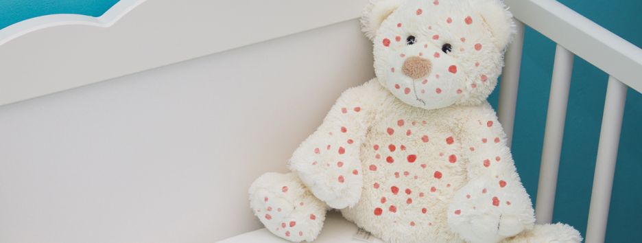 Вспышка кори в Украине не утихает: чего ждать и как уберечься