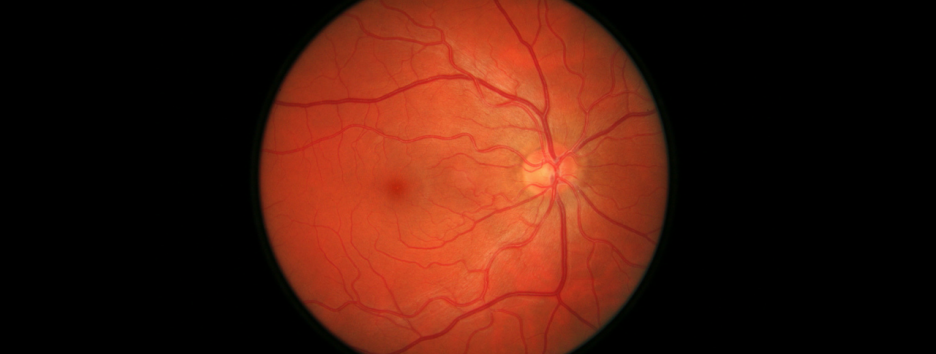 Искусственный интеллект Google научился предсказывать риск инфаркта