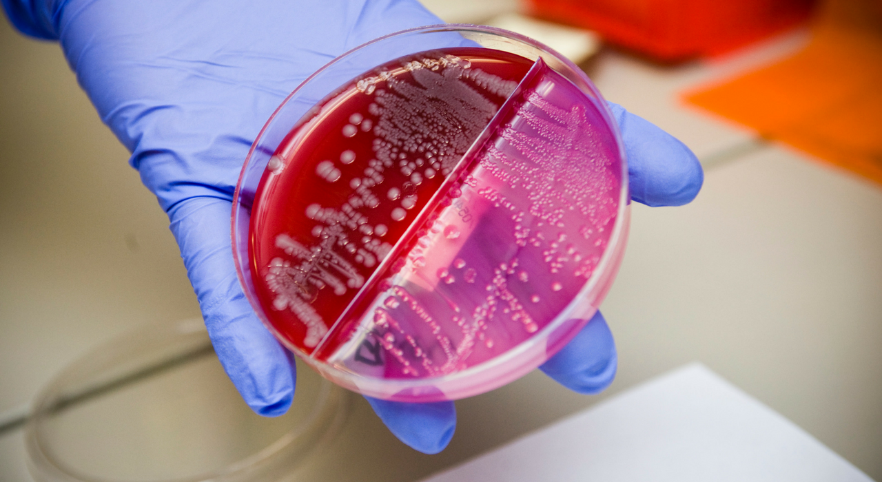 Живущие на коже бактерии могут подавлять развитие рака