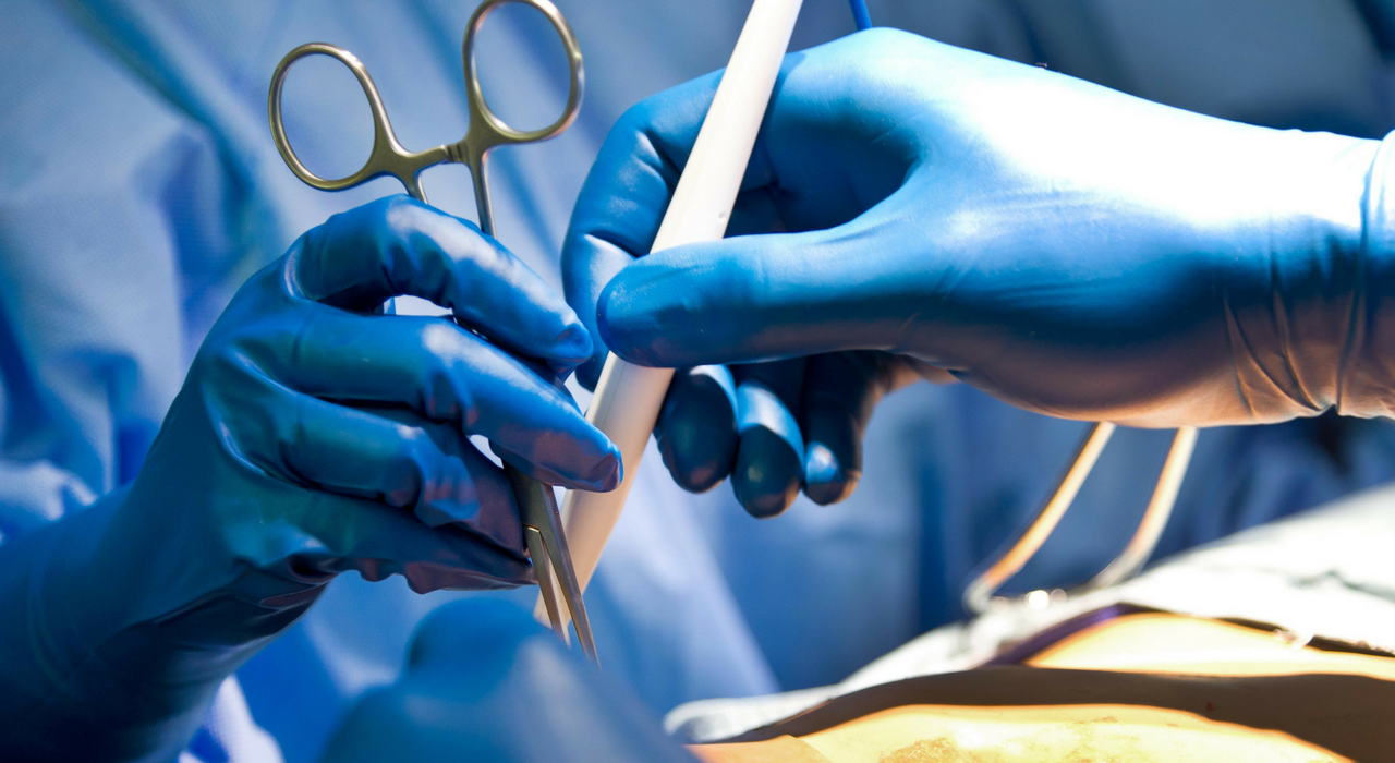 Почему американскому ветерану не пересадили яички во время трансплантации гениталий