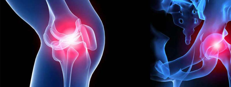 Главное — не упустить время: хирург рассказал о заболеваниях суставов