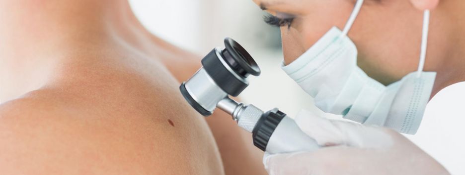 Когда родинки становятся опасными? Объясняет дерматолог