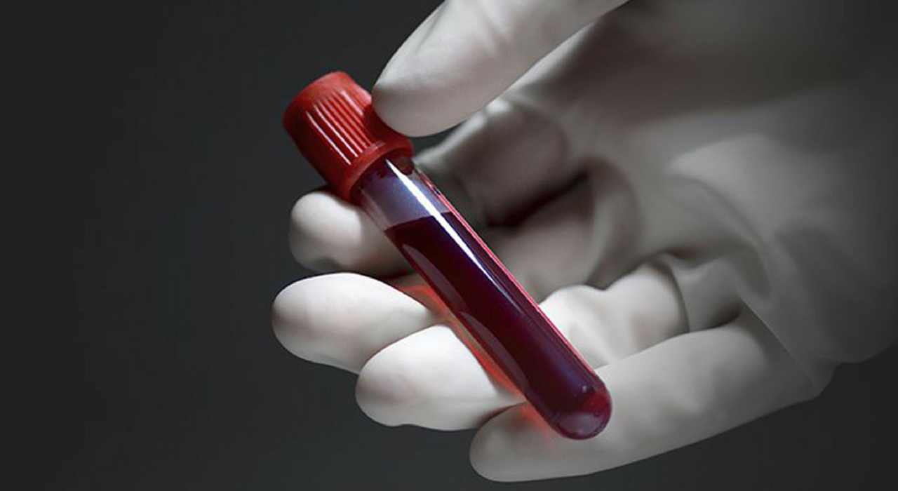Новый анализ крови превзошел биопсию в точности диагностики рака кожи