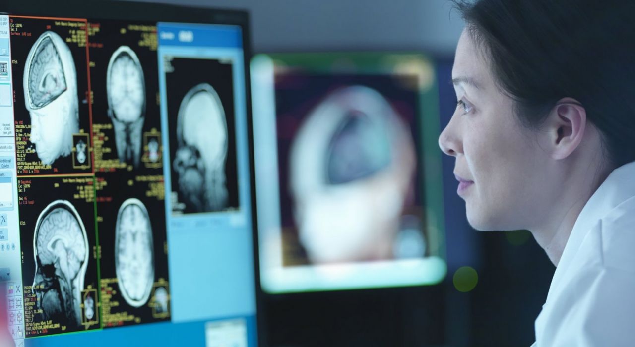 Новое сканирование мозга поможет узнать, насколько вы умны