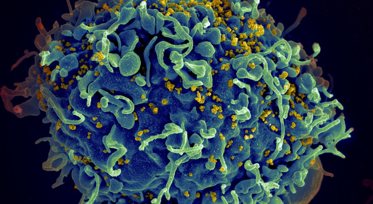 Антитела, которые нейтрализуют ВИЧ, успешно прошли испытания