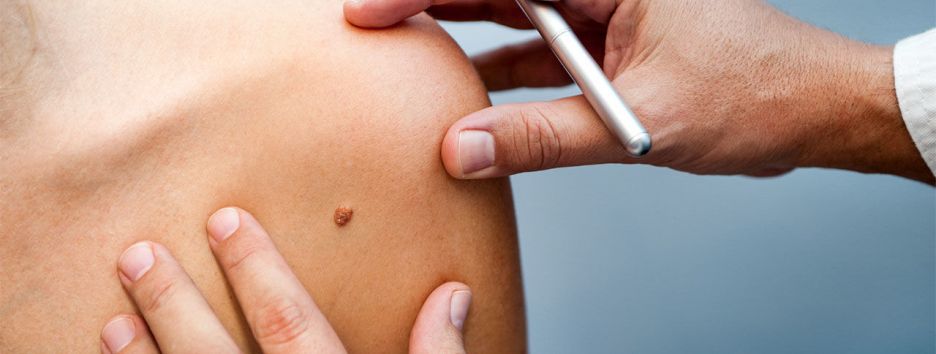 Искусственный интеллект распознает рак кожи не хуже онколога