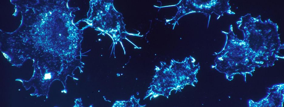 Генетический переключатель: ученые нашли эффективный способ борьбы с особо опасным раком