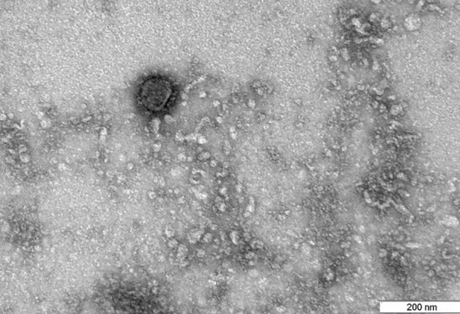 В сети появились новые фото коронавируса под микроскопом - фото 1
