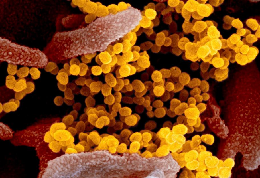 Пандемия в мире: ученые США создали первую атомную модель коронавируса - видео - фото 1
