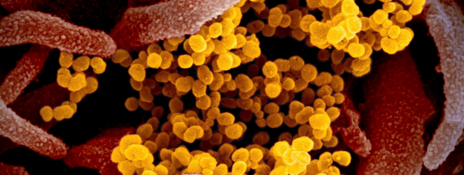 Пандемия в мире: ученые США создали первую атомную модель коронавируса - видео