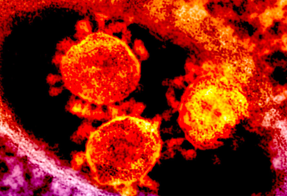 Во всем мире зарегистрировали 663,8 тыс. случаев заражения коронавирусом - фото 1