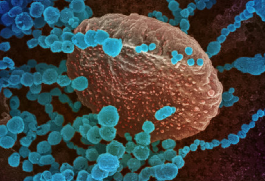 Пандемия COVID-19: ученые назвали новые факторы, увеличивающие летальность вируса - фото 1