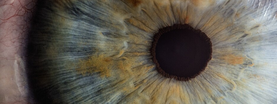 Чудеса бионики: ученые создали электрохимический глаз - фото