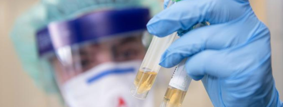 Мишени для антител: ученые нашли слабые места у коронавируса