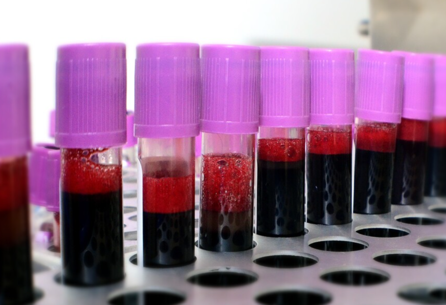 Полное омоложение - ученые нашли способ улучшить здоровье организма через кровь - фото 1