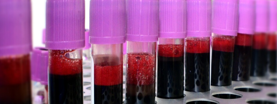 Полное омоложение: ученые нашли способ улучшить здоровье организма через кровь