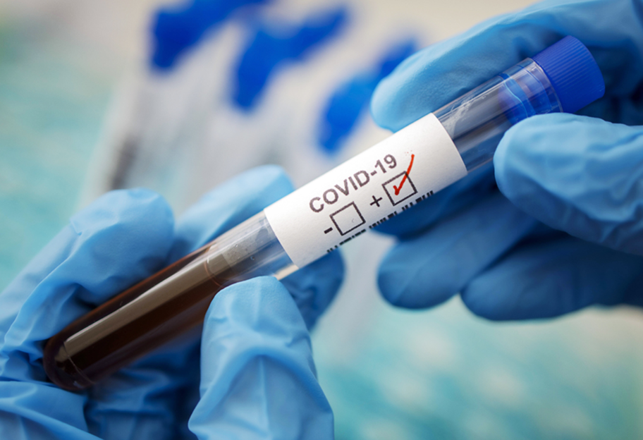 Кровь и COVID-19 - ученые назвали самую восприимчивую к коронавирусу группу людей - фото 1