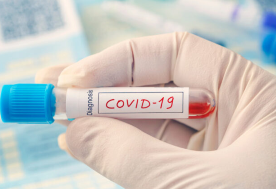 Пандемия COVID-19 - в мире заболели 9,4 миллиона человек, в Украине число больных превысило 40 тысяч - фото 1