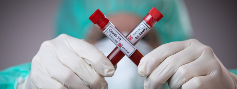 Пандемия COVID-19: в мире заболели 10,4 миллиона человек, в Украине 664 новых случая