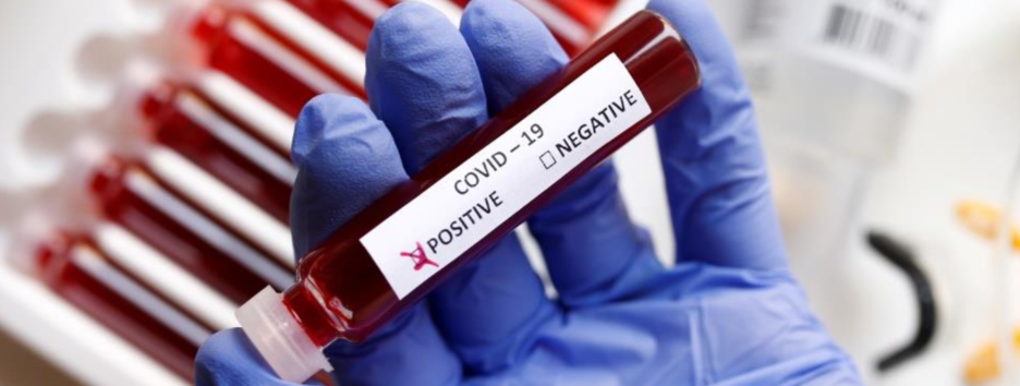 «Мы все еще в первой волне»: в ВОЗ озвучили тревожный прогноз по пандемии COVID-19