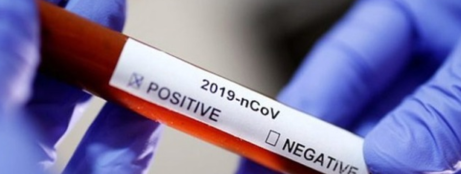 Пандемия СOVID-19: число больных в мире превысило 18 миллионов, в Украине 990 новых случаев