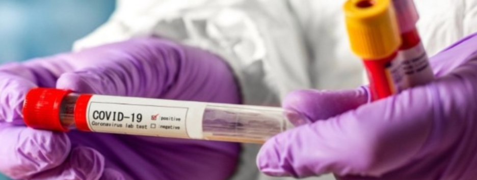 Пандемия СOVID-19: число больных в мире превысило 19 миллионов, в Украине два новых антирекорда