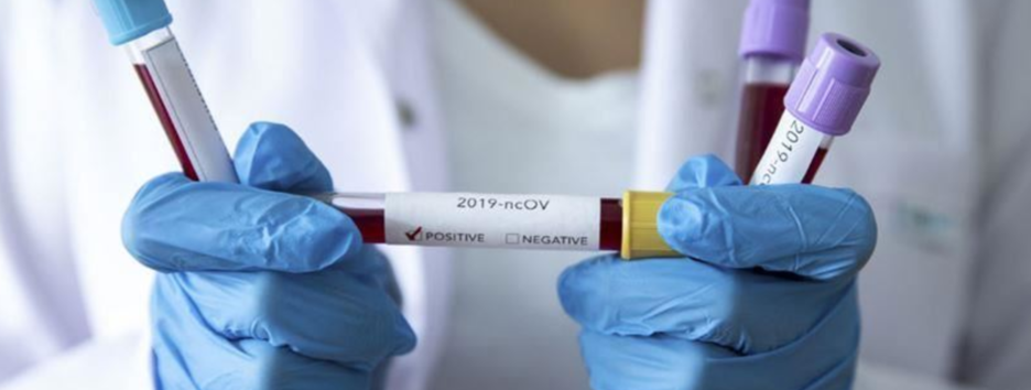 Пандемия COVID-19: в Украине вновь антирекорд по смертности, в мире более 26 миллионов больных