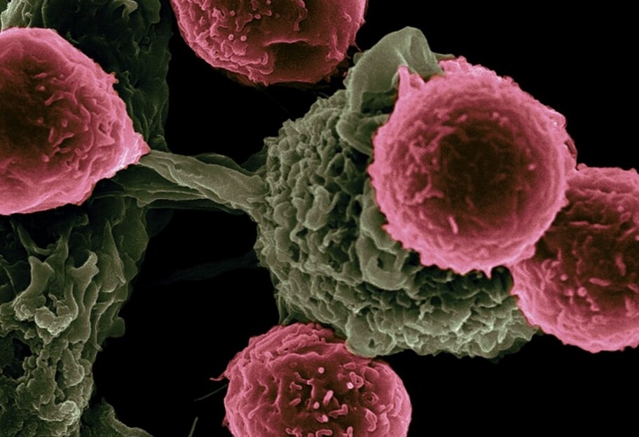 Предотвратить смертельную стадию - ученые сделали важное открытие о метастазах рака - фото 1