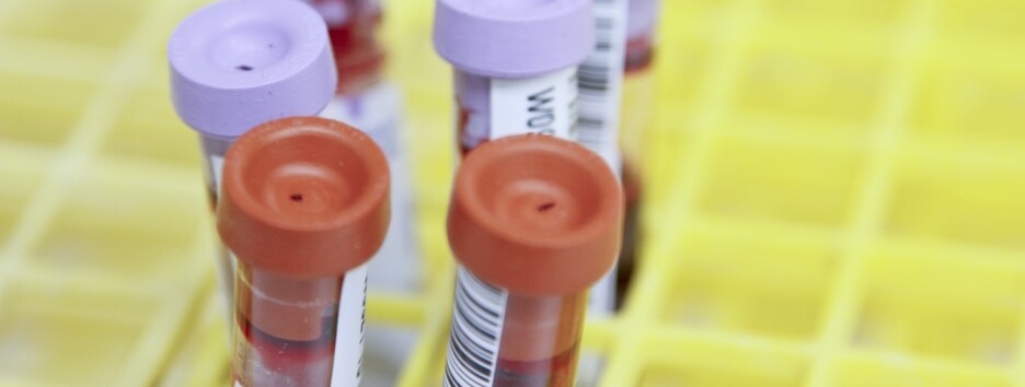 Найти и «понять» опасный вирус: объявлены лауреаты Нобелевской премии по медицине – фото