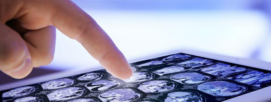 «Затяжний COVID»: вчені розповіли про «виснажливих» наслідки коронавируса