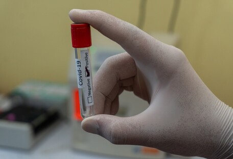 Новини пандемії: в Україні новий антирекорд, вчені вивчили заразність хворих без симптомів - фото