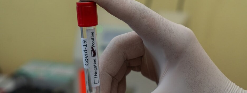 Словакия отложила второе массовое тестирование на COVID-19: названы причины