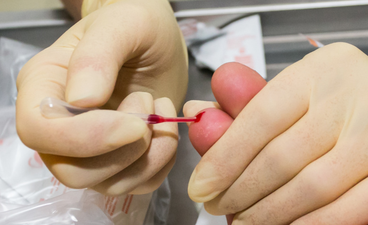Выявляет 50 видов рака: в Британии проходят испытания анализа крови на онкологию
