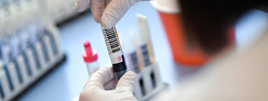 Пандемія COVID-19: в світі 66 мільйонів чоловік заразилися коронавірусів, в Україні знизилася захворюваність