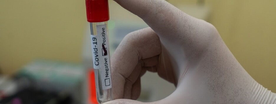 У боротьбі з пандемією: стало відомо, скільки українців повторно заразилися ковідом