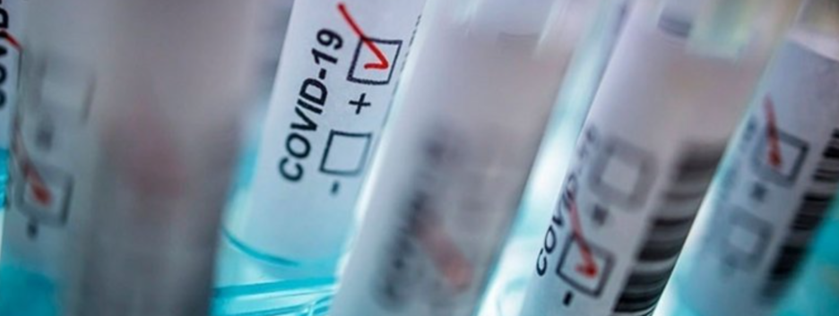 Пандемія COVID-19: в Україні п'ятий день поспіль число тих, що видужали більше числа тих, що заразилися