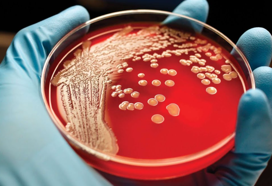 Победить инфекции - ученые нашли супербактерии для борьбы с заболеваниями - фото 1