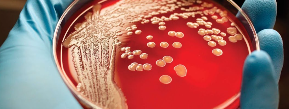 Устойчивые к лекарствам бактерии: ученые нашли способ бороться со смертельными инфекциями