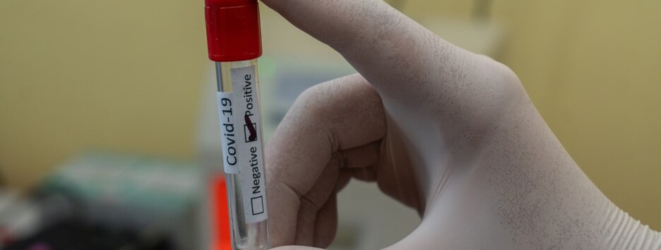 «Передбачити» ковід: незвичайні симптоми коронавірусу, на які потрібно звернути увагу