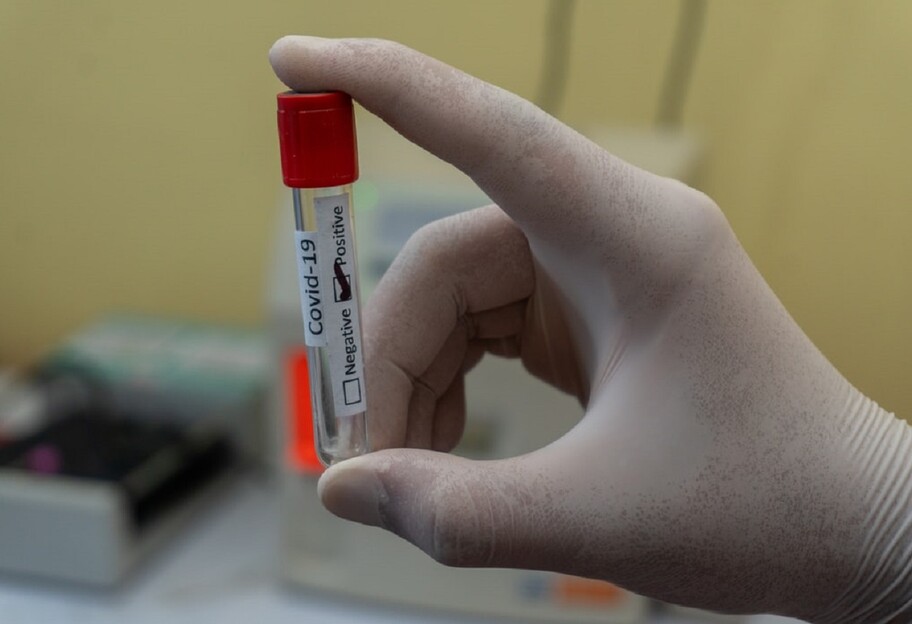 Лікування коронавірусу - медики навчилися визначати тяжкохворих ковідом - фото 1