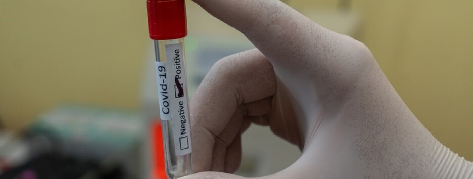 Передбачити важкий ковід: вчені зробили важливе відкриття у вивченні коронавірусу