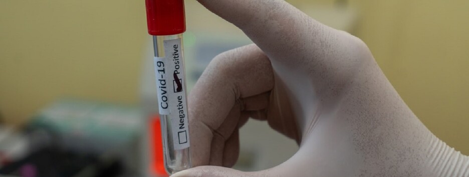 Загрозливий прогноз: в Китаї заговорили про нову епідемію коронавірусу